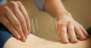 Acupuncture Montreal